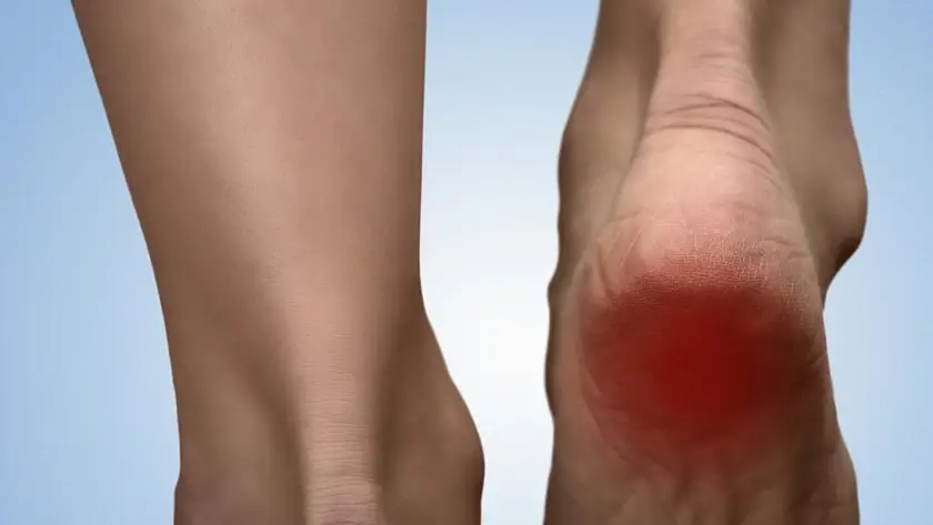 Dealing With Chronic Heel Pain? Here Are Some Ways You Can Get The Pain Under Control
